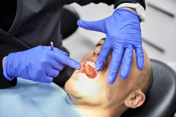 Best Emergency Gum Treatment in Tolar, TX