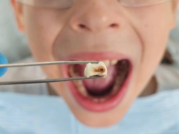 Best Same-Day Emergency Dental Services in Tolar, TX
